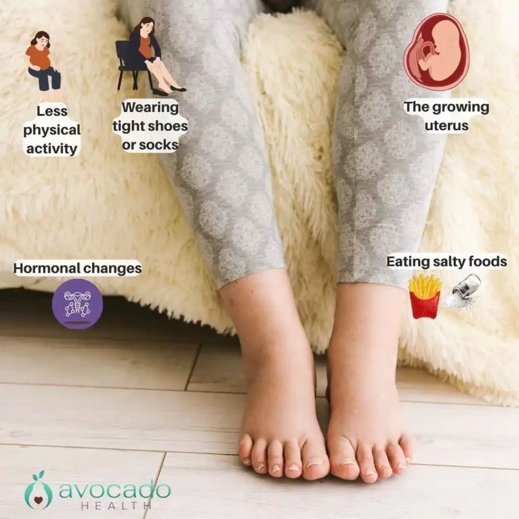 What Causes Swollen Feet During Pregnancy
